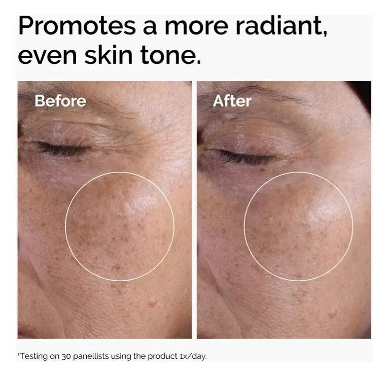 The Ordinary - Glycolic Acid 7% - Toning Solution - It Suplementos
