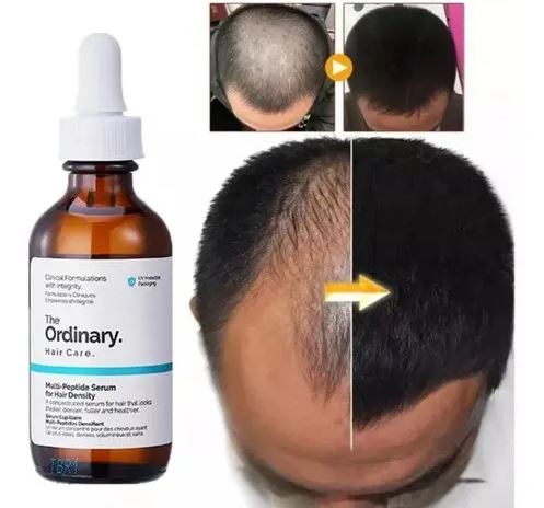 The Ordinary Multi - peptide Serum For Hair Density, 60 Ml - It Suplementos